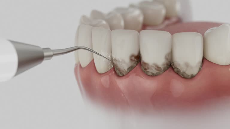 Reliable Dental contractor in Bismarck, ND by Dentist Open Now